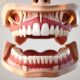 8 key signs you need dental implants